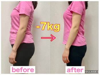 骨盤整体 サクラ(Sakura)/ビフォーアフター/妊婦産後骨盤