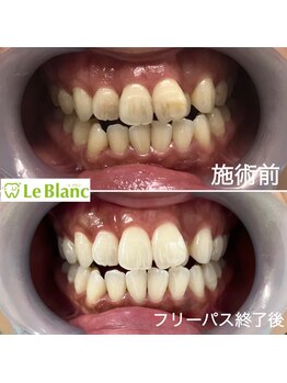 ルブラン 奈良店(Le Blanc)/歯のお悩み解決!