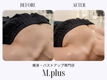 エムプリュ 心斎橋店(M.plus)/バストアップコース1回