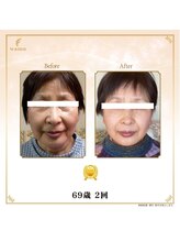 ビモア(美more)/お客様４ フェイシャル