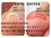 アマル (AMAL)の雰囲気（巻き爪ケアも得意メニューです★痛みのある方ご相談くださいませ）