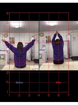 ストレチックス 近江八幡店/BeforeAfter