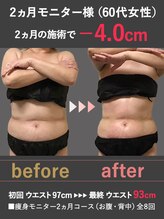 蓮子の夢/2か月で-4.0cm！