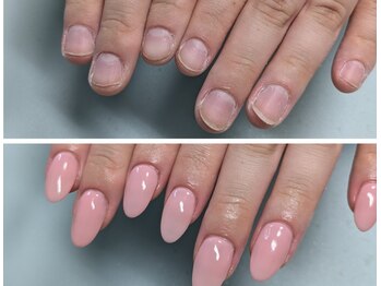 ブルートネイル(Blueat Nail)の写真/爪のお悩みは人それぞれ…自爪に優しいフィルイン導入サロン！お爪が薄い方、短い方必見！！