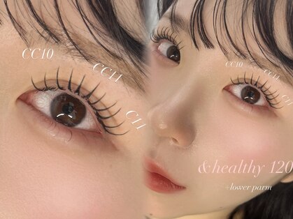 ミニョン(Mignon)の写真