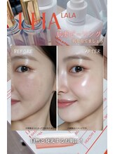 スリーナイン ビューティー(39 beauty)&nbsp;MOMO 