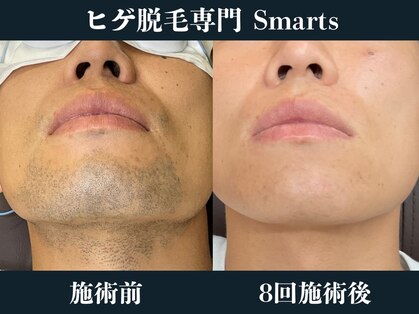 スマーツ(Smarts)の写真