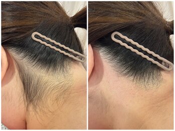 ファミーユ 太田(Fameu)/襟足wax