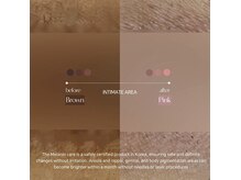 イオ(‘IO)の雰囲気（話題のメラニン除去◇厳選した製剤を韓国より取り寄せております）