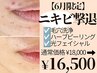 【頑固なニキビを徹底ケア】毛穴洗浄+ピーリング+光フェイシャル