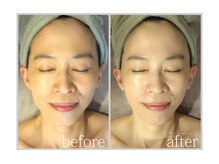 アン グレーヌ 自由が丘(unegraine)/うるおう！透明肌