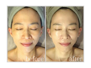 アン グレーヌ 自由が丘(unegraine)/うるおう！透明肌