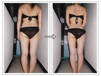 ルッチョラ(Lucciola)/ビフォーアフター