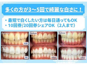 ホワイトニングショップ 鹿児島店