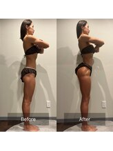 フィエルテ 甲斐敷島(FIERTE)/お客様 Before After