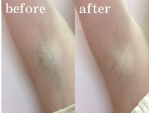 ブランピュールの雰囲気（【リーズナブルで通いやすい】ずっと綺麗にを叶える価格設定）