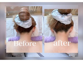 肌ピュア/#脱毛#四日市#桑名#うなじ脱毛