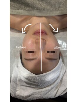 カーム(CALM.)/フローズン顔　左右の変化