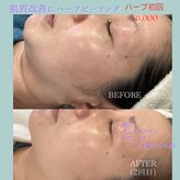 ビューティーサロン セガール(segar)