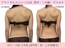 ラエッセ(La Esse)/天使のはね爆誕