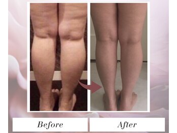 トータルビューティー筋膜ケアサロン カンスタイル(Kanstyle)/足スッキリ！