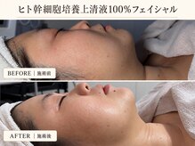 サロン ド ミュゲの雰囲気(ヒト幹細胞培養上清液、冷凍原液100%使用で濃さが違う◎)