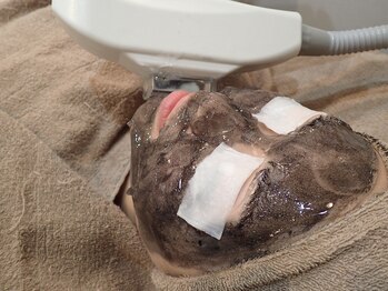 アンシャンテ(En chan te)/カーボンフェイシャル