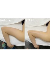 エクスクラメーションマーク(!!!)/★二の腕★