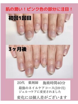 アーラ バイ ヴィアルーチェ(aLa by VIALUCE)/爪を美しく!育成ネイルケア☆