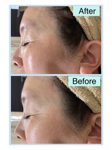 サロン ド チェリー 西町店(Salon de Cherry)/光フォト