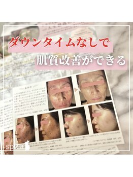 スピカ(Spica)/すべての肌悩みへアプローチ!