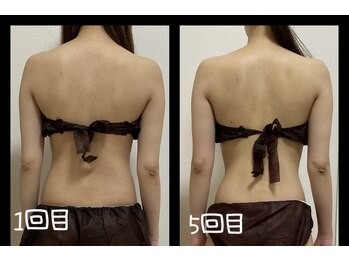 レインボー(Rainbow)/