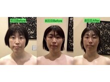 アジール 長岡リバーサイド千秋店(agir)/before/after画像