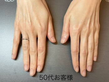 桃の木 吉祥寺店/綺麗な手は維持出来ます 2