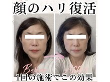 アシュネ(Axiune)の雰囲気(たるみ,ほうれい線,浮腫みなど、大人女子のお悩みを徹底解消!)