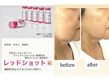 チャルム(CAL'ME)