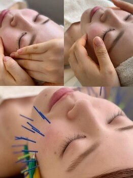 チョコバリ 渋谷店(chocobari)の写真/美容鍼でシワ/たるみ/ほうれい線を改善◎肌のターンオーバーを正常化させ、内側から輝くハリのある美肌に♪