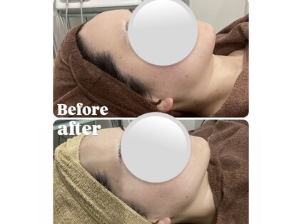 ニコリー(nicoly)の写真