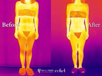 リフィール たまプラーザ店(refiel)/見えるインディバの力