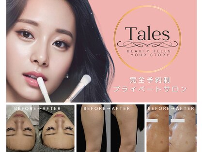 テイルズ(Tales)の写真
