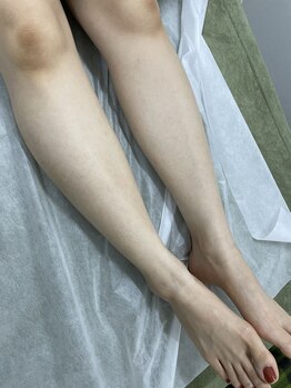 ナノハナ/鹿沼市の全身脱毛美容室ナノハナ