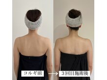 セミル(SEMIRU)/コルギで後ろ姿も変わる