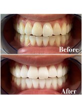 ライトビューティー 池袋店(LightBeauty)/症例写真