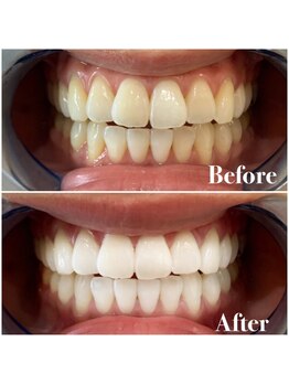 ライトビューティー 池袋店(LightBeauty)/症例写真