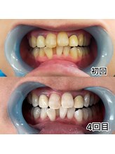 フレスコ レディース 刈谷店(FRESCO)/ホワイトイング