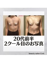 クレット 銀座店(Cret)/開始から数ヶ月後☆