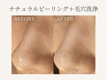 リノ(Lino)/BeforeAfter