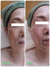 ニワ(Niwa)/バザルトフェイシャル