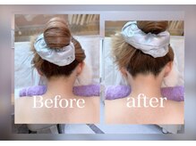 肌ピュアの雰囲気(【うなじ脱毛】うなじから始まる上品な印象#うなじ脱毛#全身脱毛)