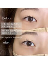 クレー(Klee)/アンドヘルシー、LED